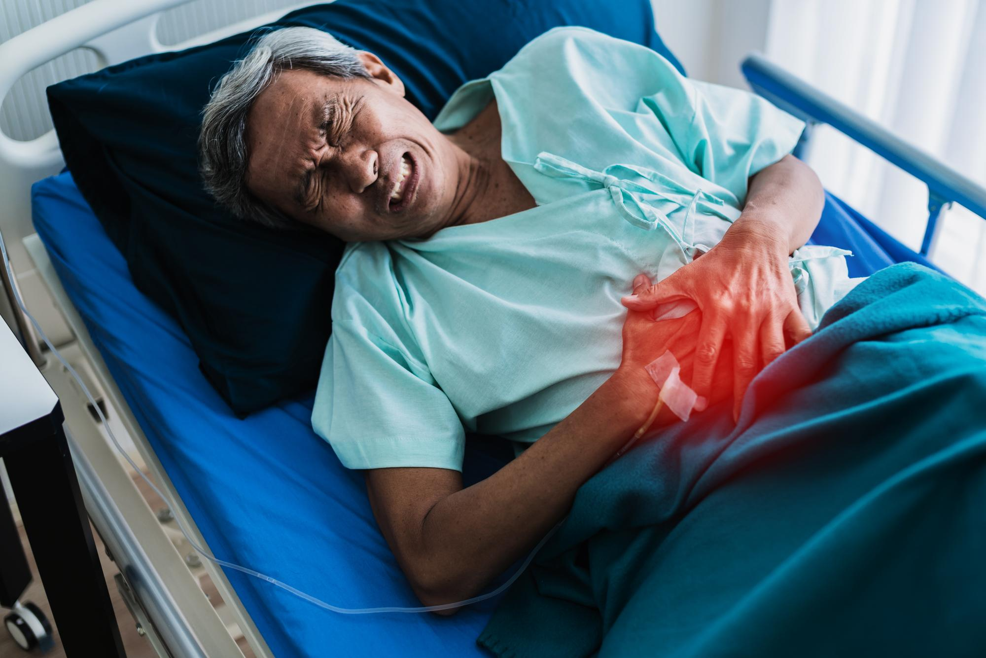 stomach cancer