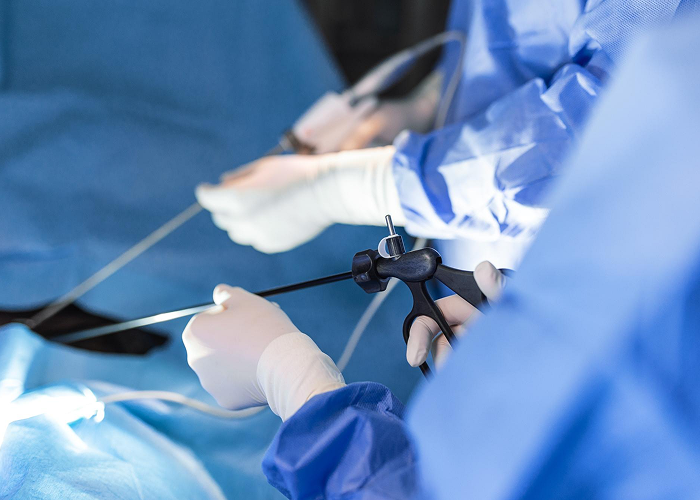 Gall Bladder Surgery