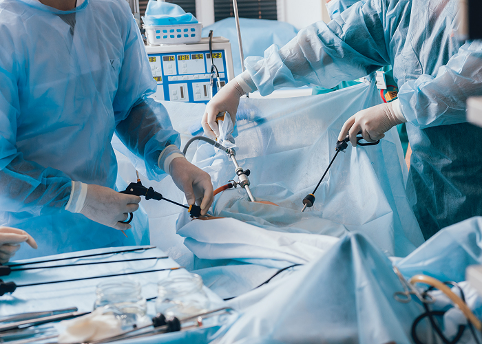 Laparoscopic Surgery